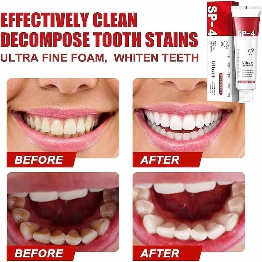 Yayashi SP-4 Ultra Whitening Toothpaste | Stain Remover & Fresh Breath Formula - Image 4